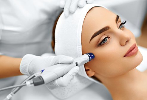 Microdermabrasion – What is it? How does it work?